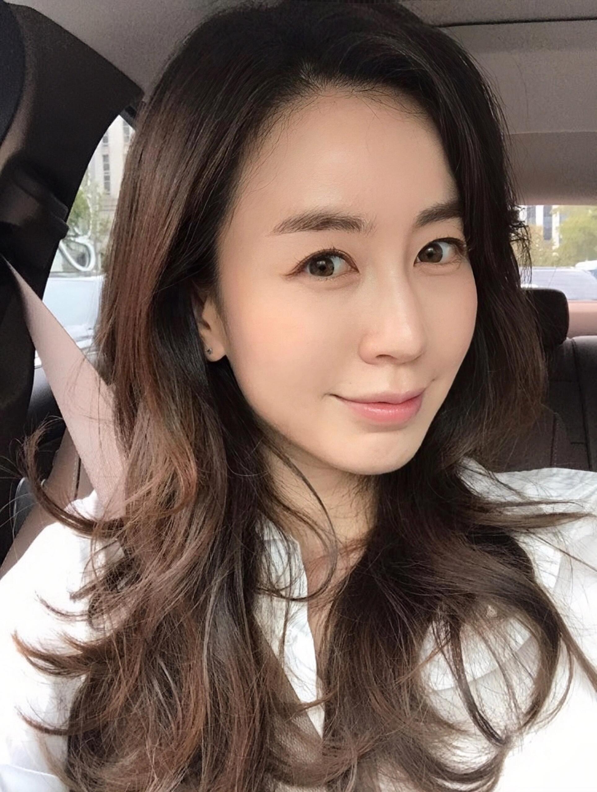 于是我就想变年轻了听朋友说过几次眼周筋膜提升圆脸女生照片35岁