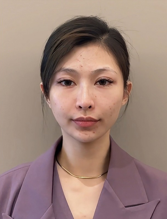 41岁想再婚,拿出全部彩礼做成幼态脸,男方却说他不要