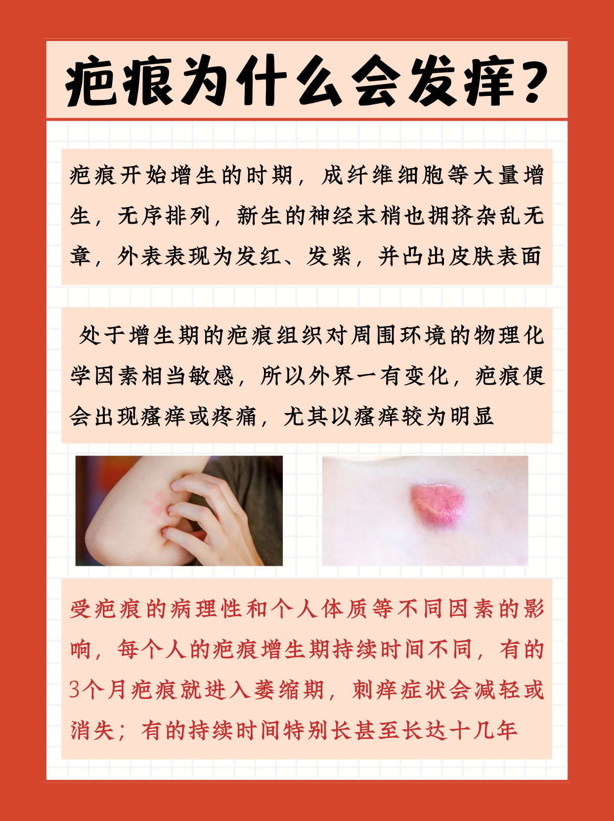 疤痕增生可以不管它吗为什么在线 疤痕增生可以不管它吗为什么在线