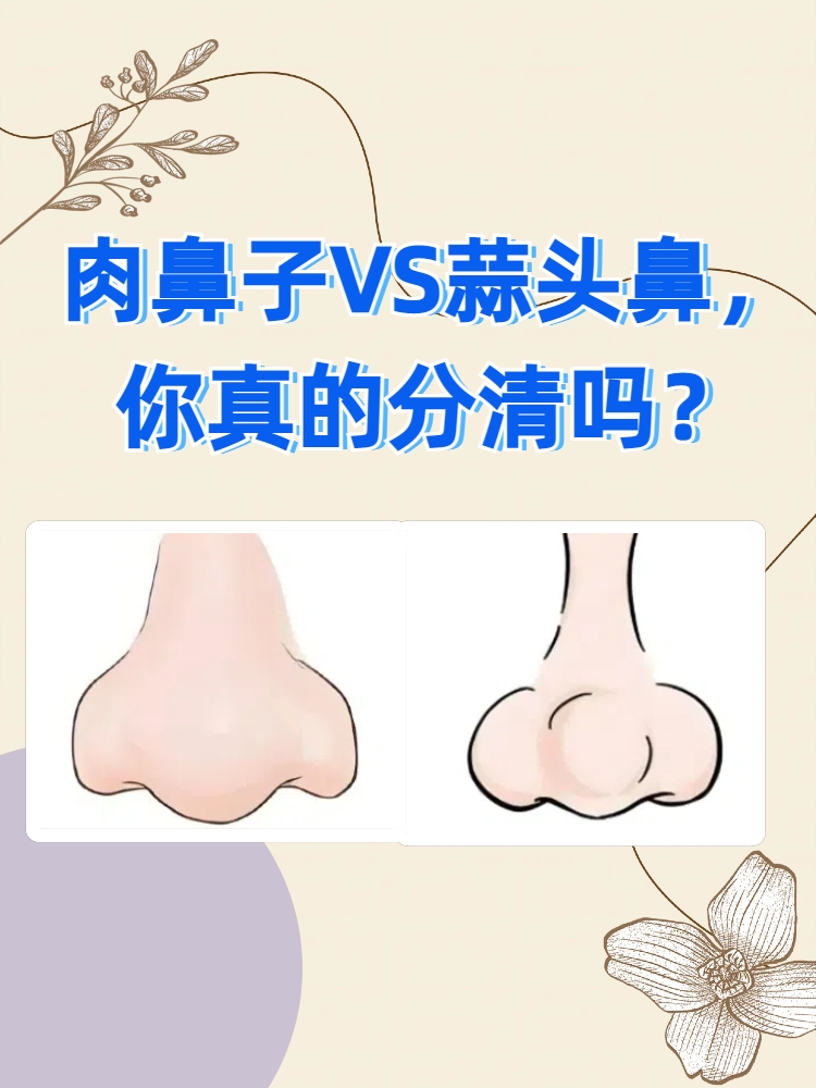 肉鼻子,顾名思义,就是鼻子部位相对较为饱满,圆润,给人一种"肉嘟嘟"