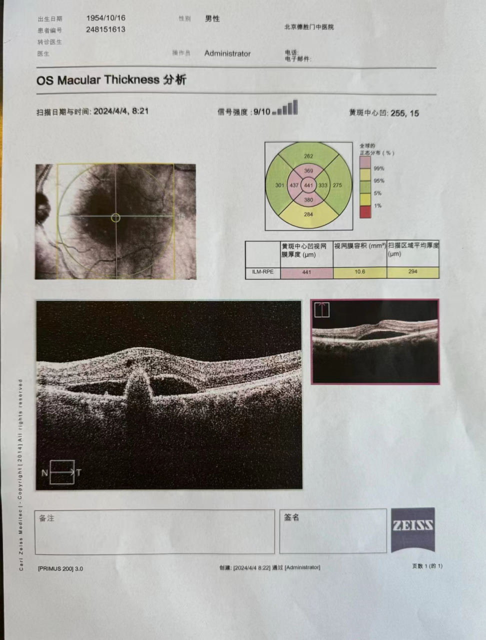 中医对老年性黄斑病变(又称年龄相关性黄斑变性,amd)的看法和治疗理念