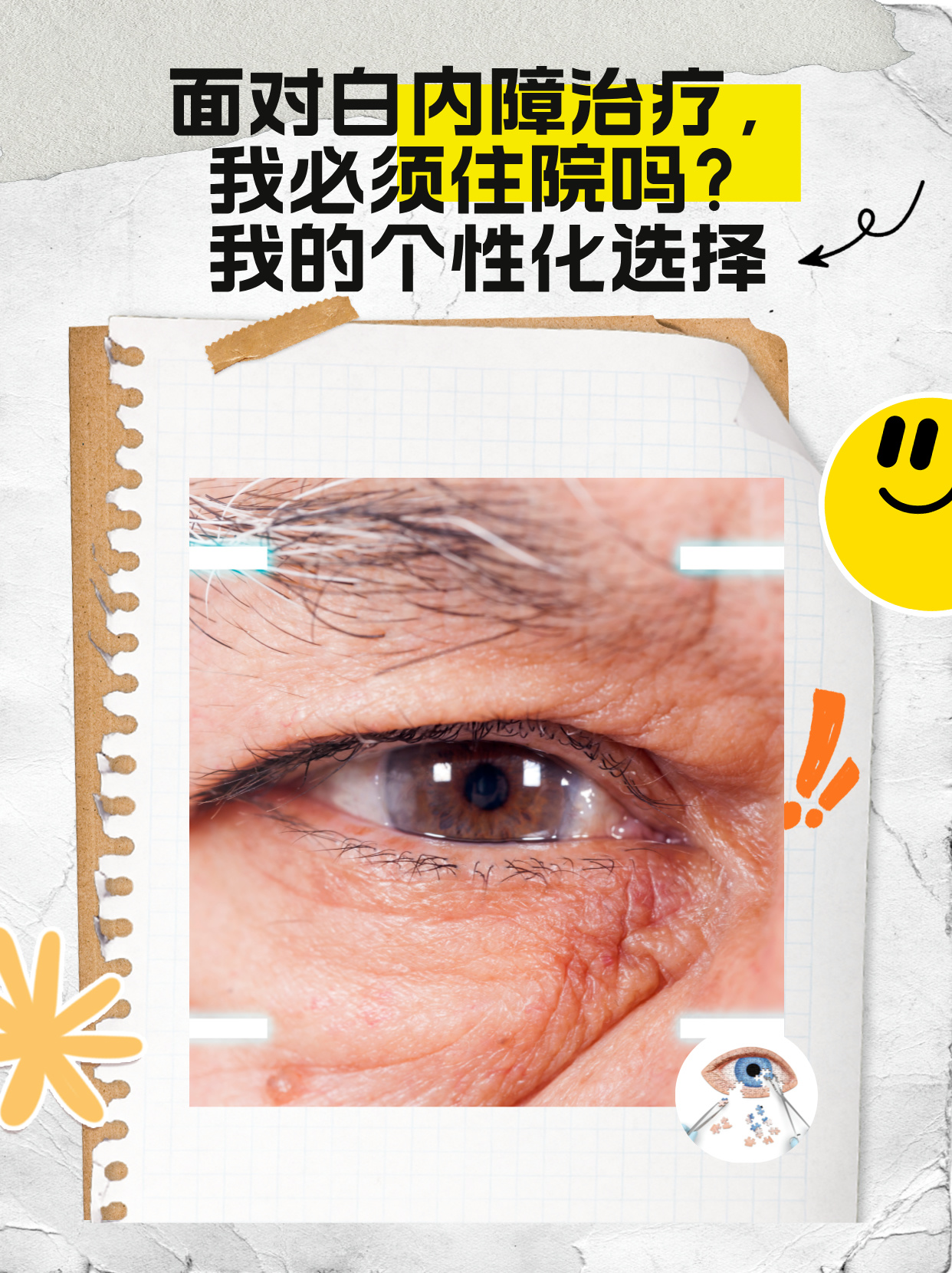 我的个性化选择 白内障手术是治疗白内障,恢复视力的一种常见方法.