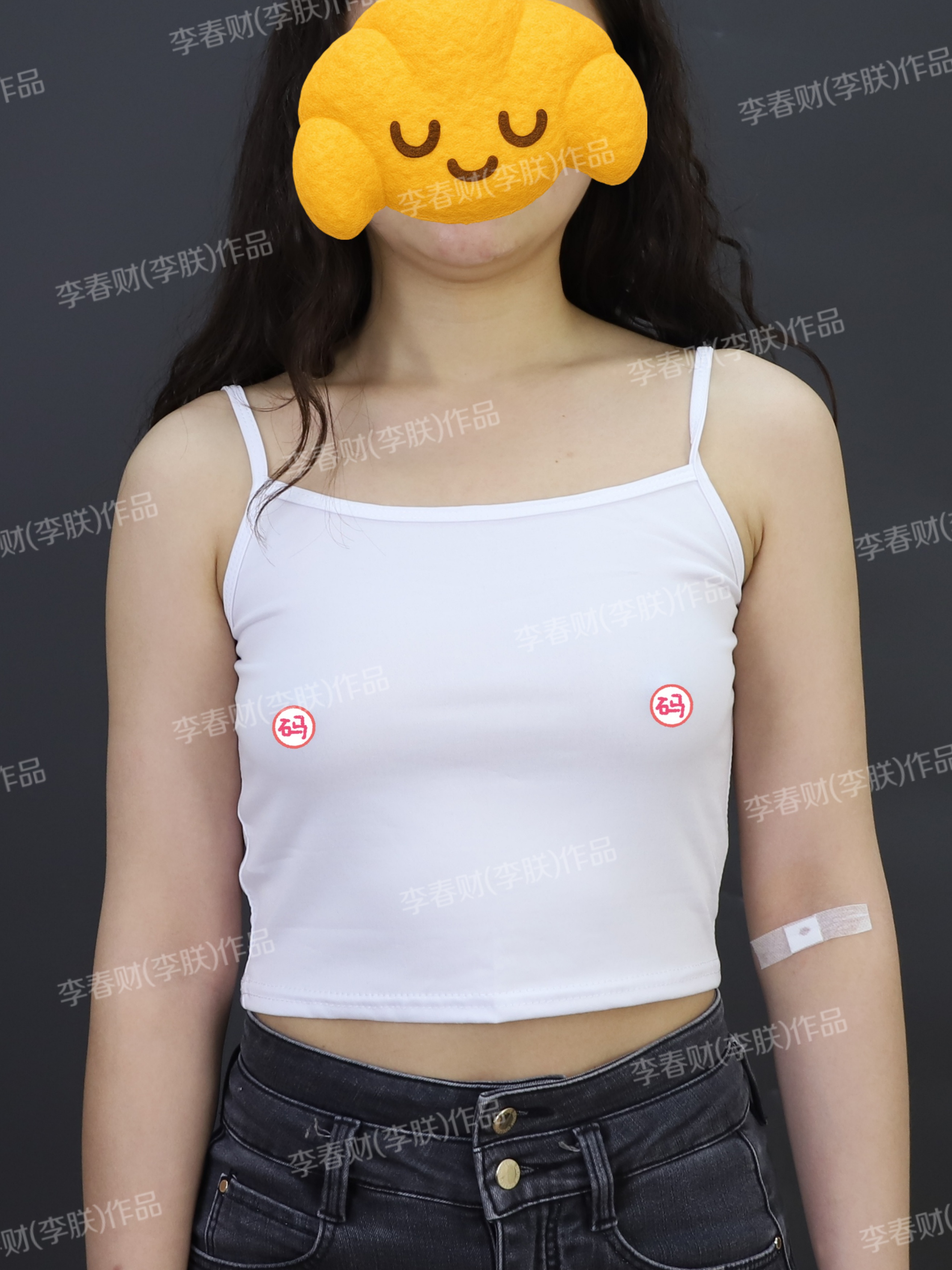 术后反馈,罩杯升b ,腰变瘦腿变细,宽肩