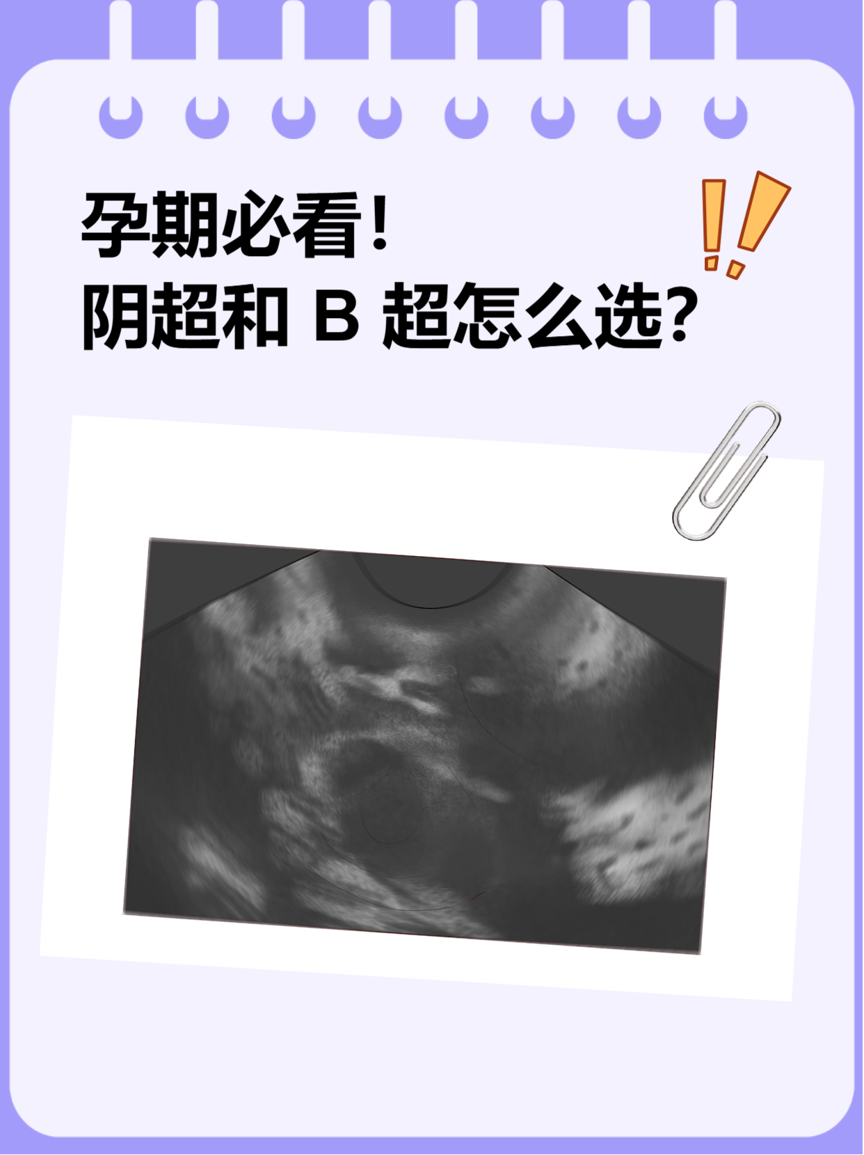 阴超和 b 超怎么选?