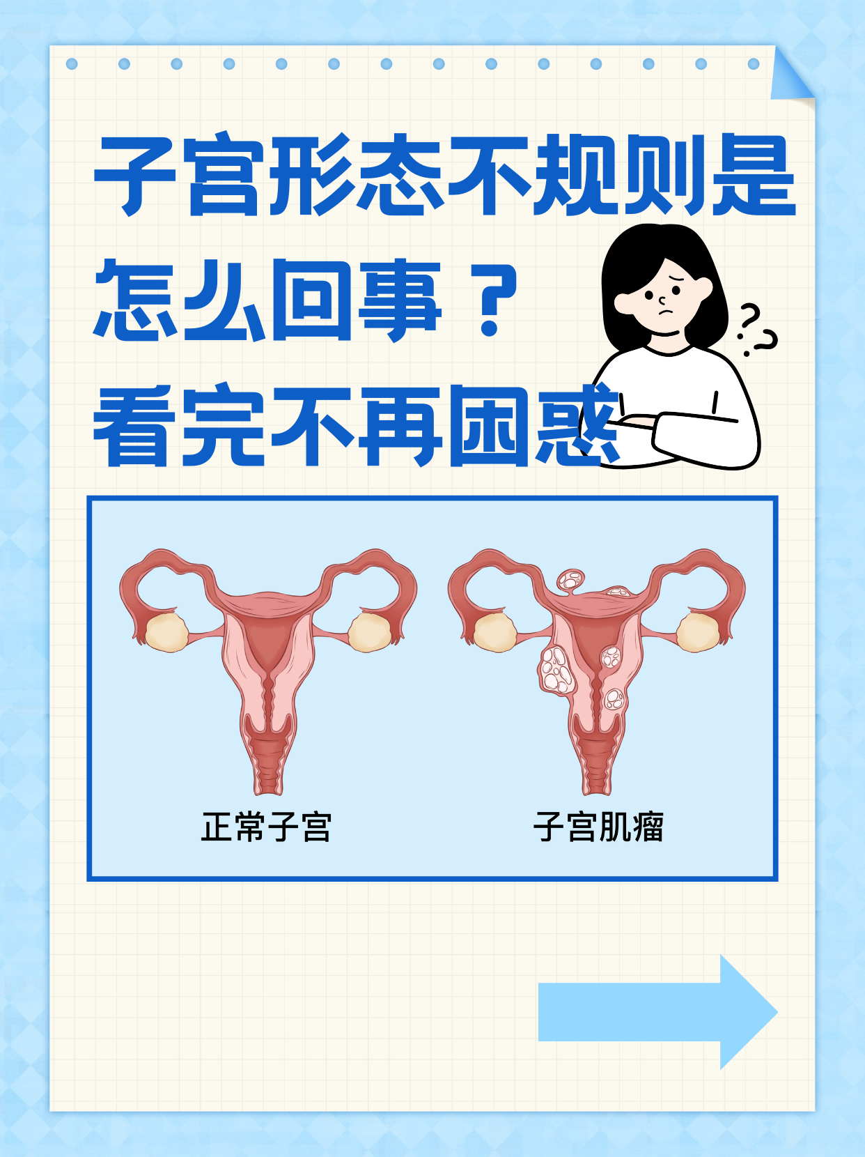 看完不再困惑 子宫是女性重要的生殖器官,正常情况
