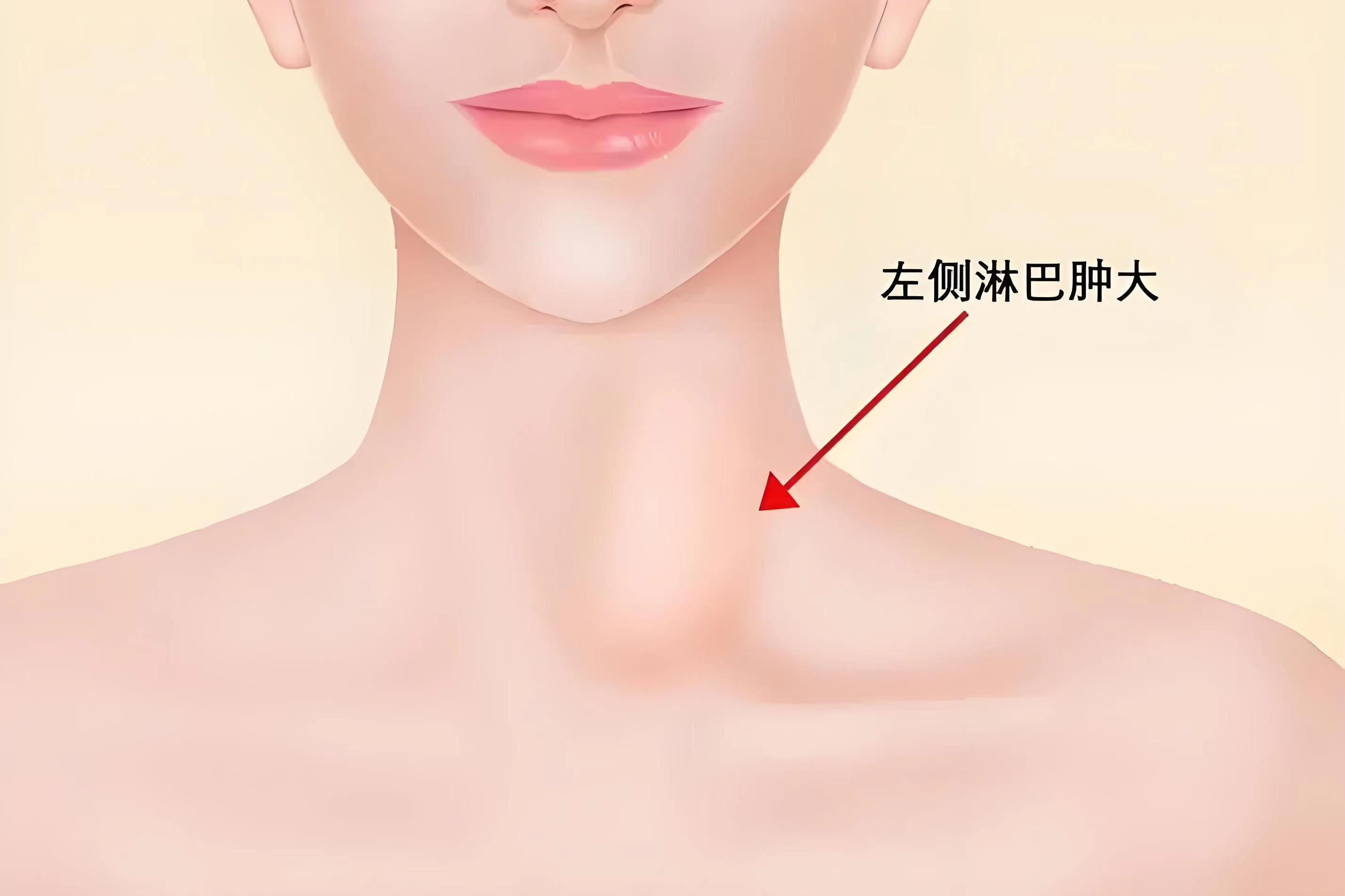 枕后淋巴结疼图片