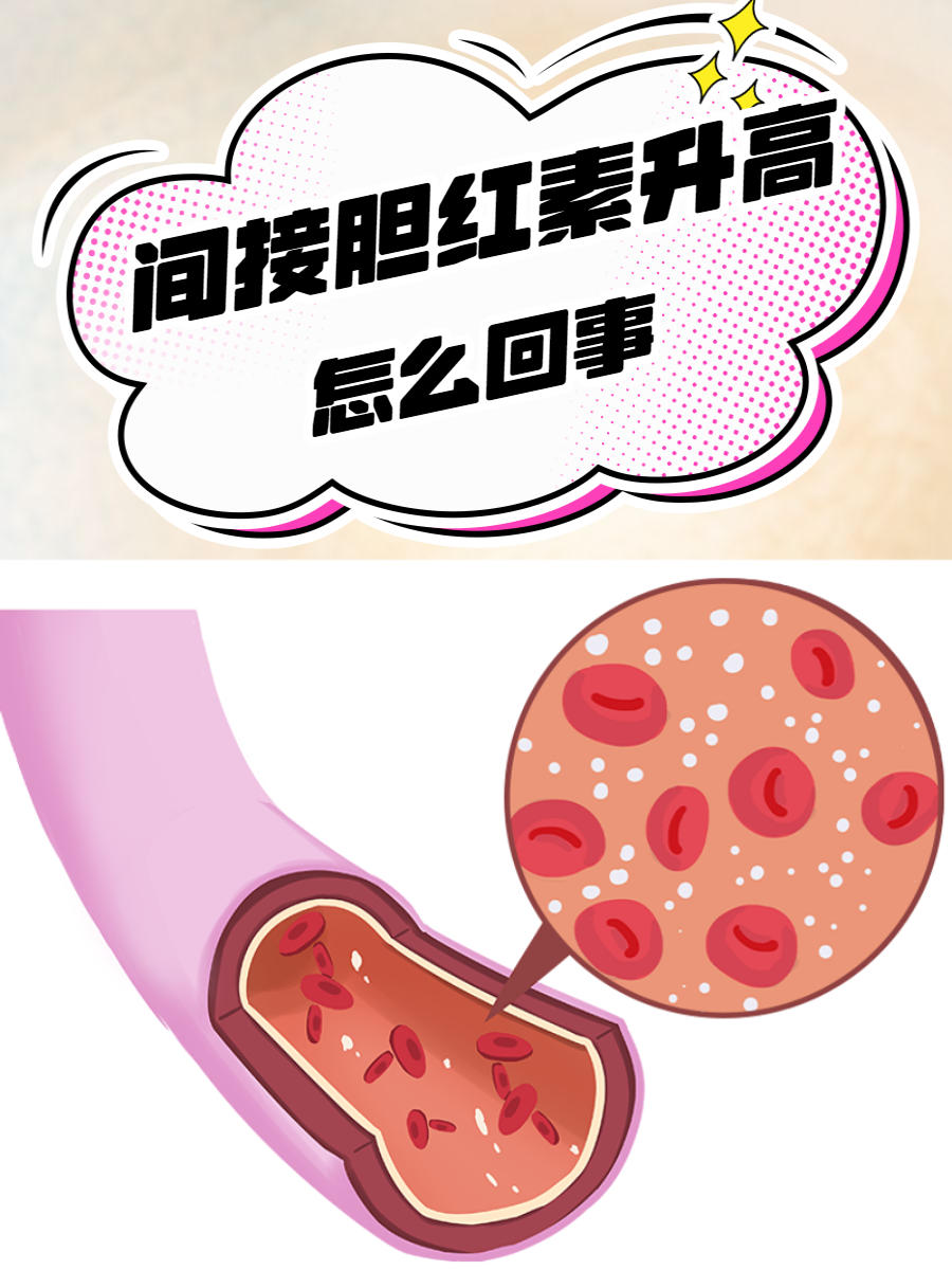 快来了解具体原因  体检项目中,间接胆红素水平的变动尤为值得关注,它