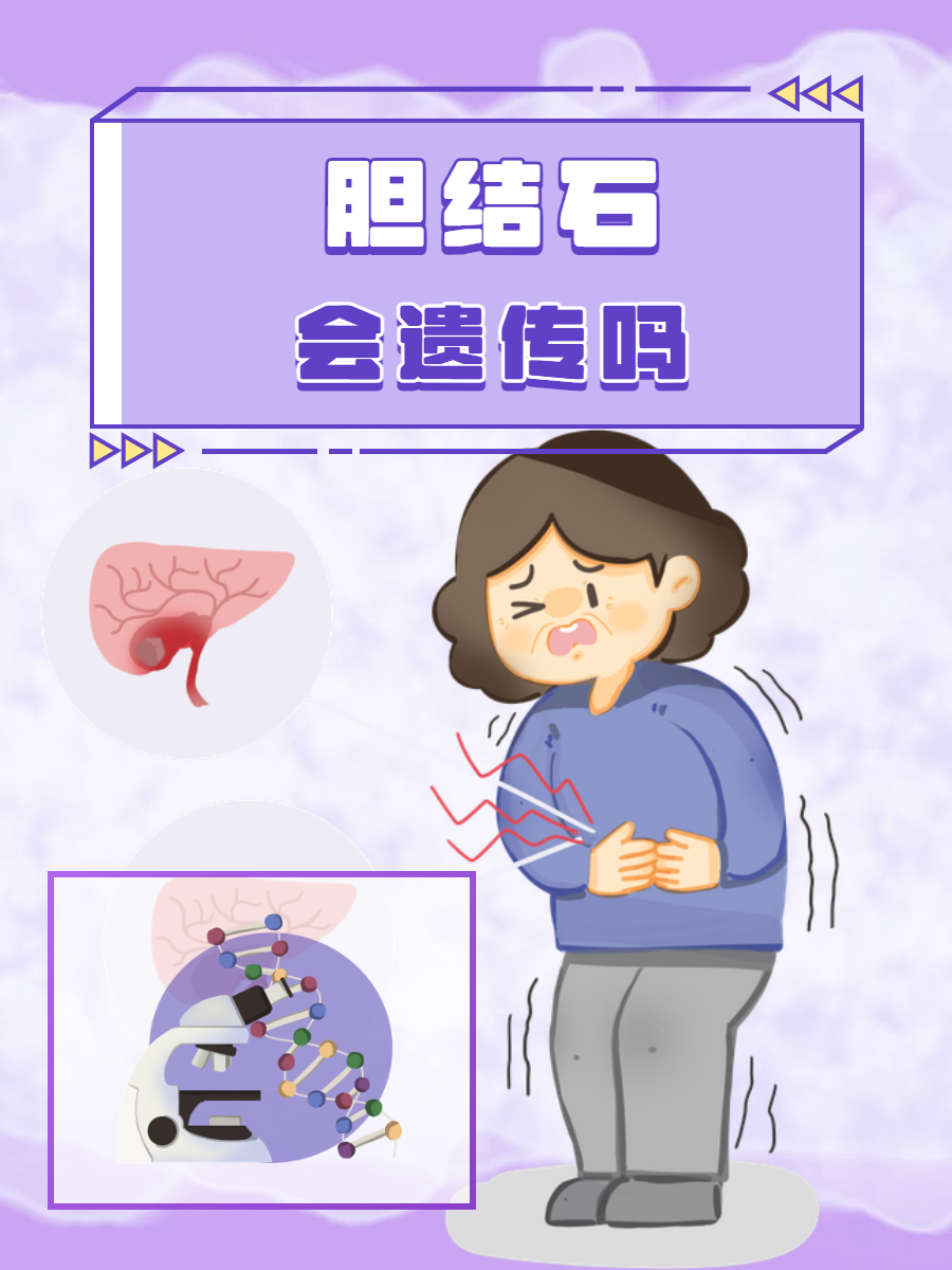 为什么会胆结石和息肉为什么在线