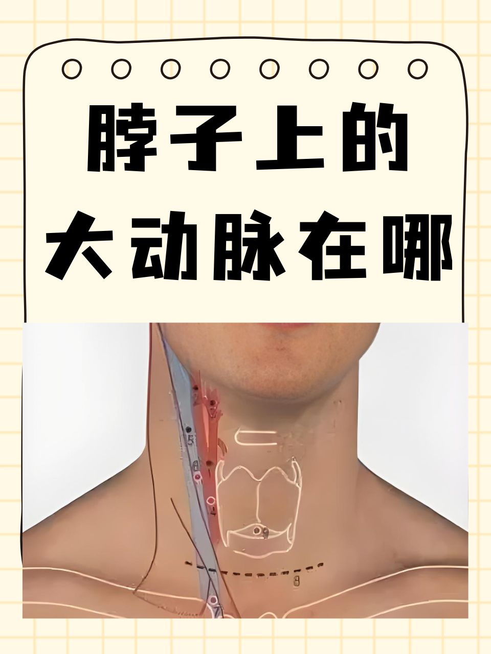 颈动脉管外口的位置图片