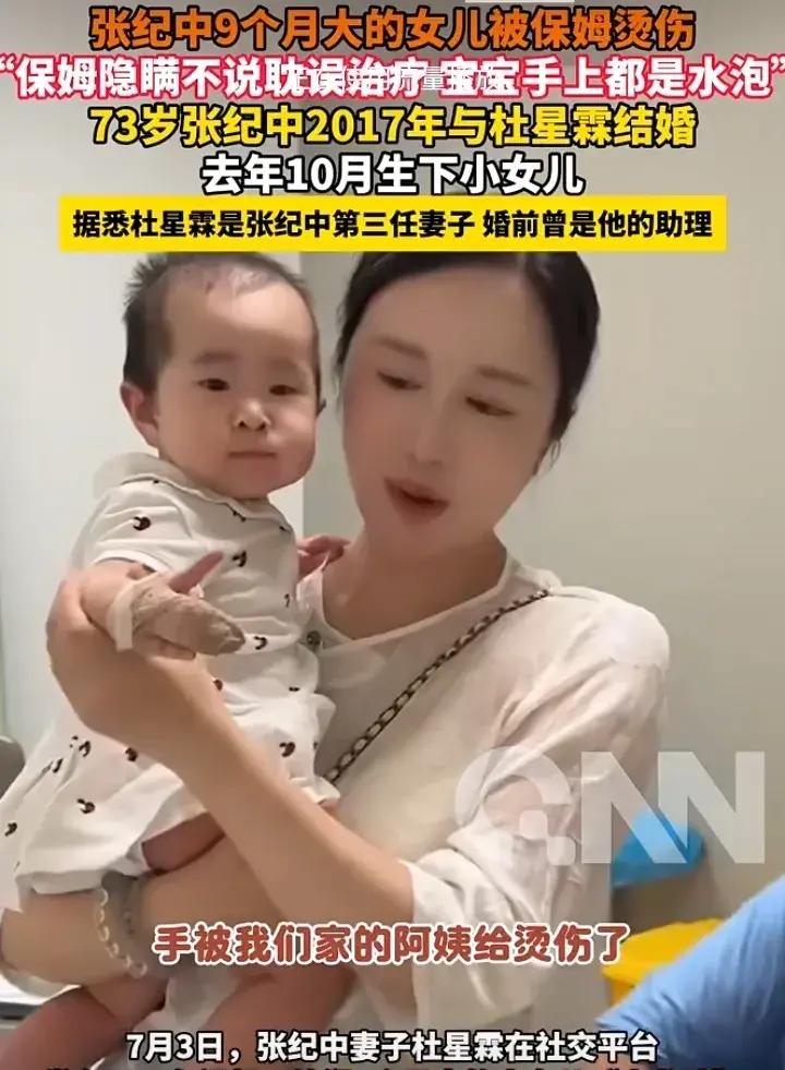 张纪中九个月大的女儿"小龙珠"被保姆烫伤