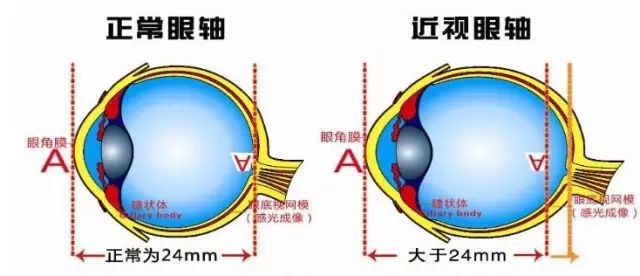 睫脊反射图片