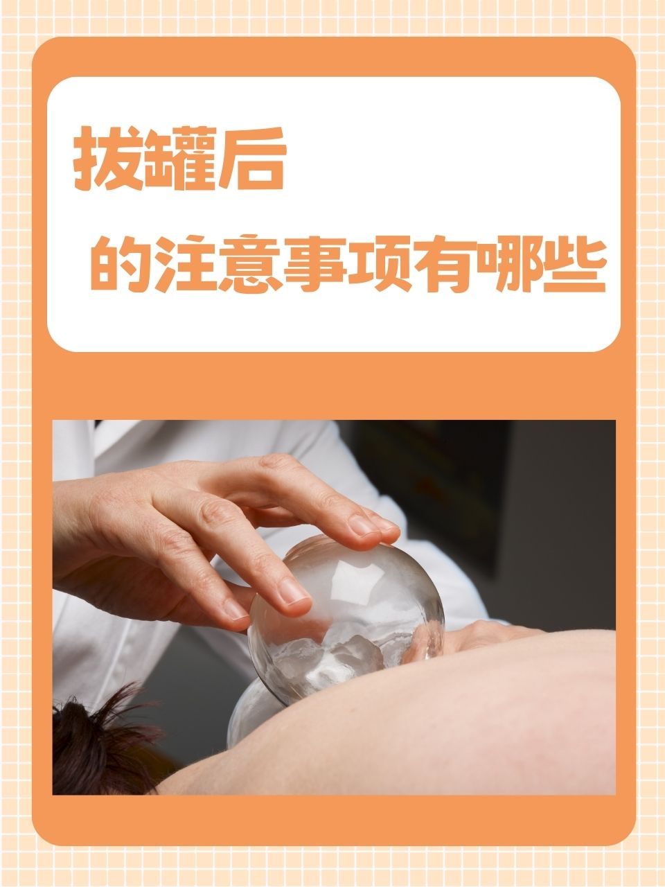 拔罐后的注意事项有哪些