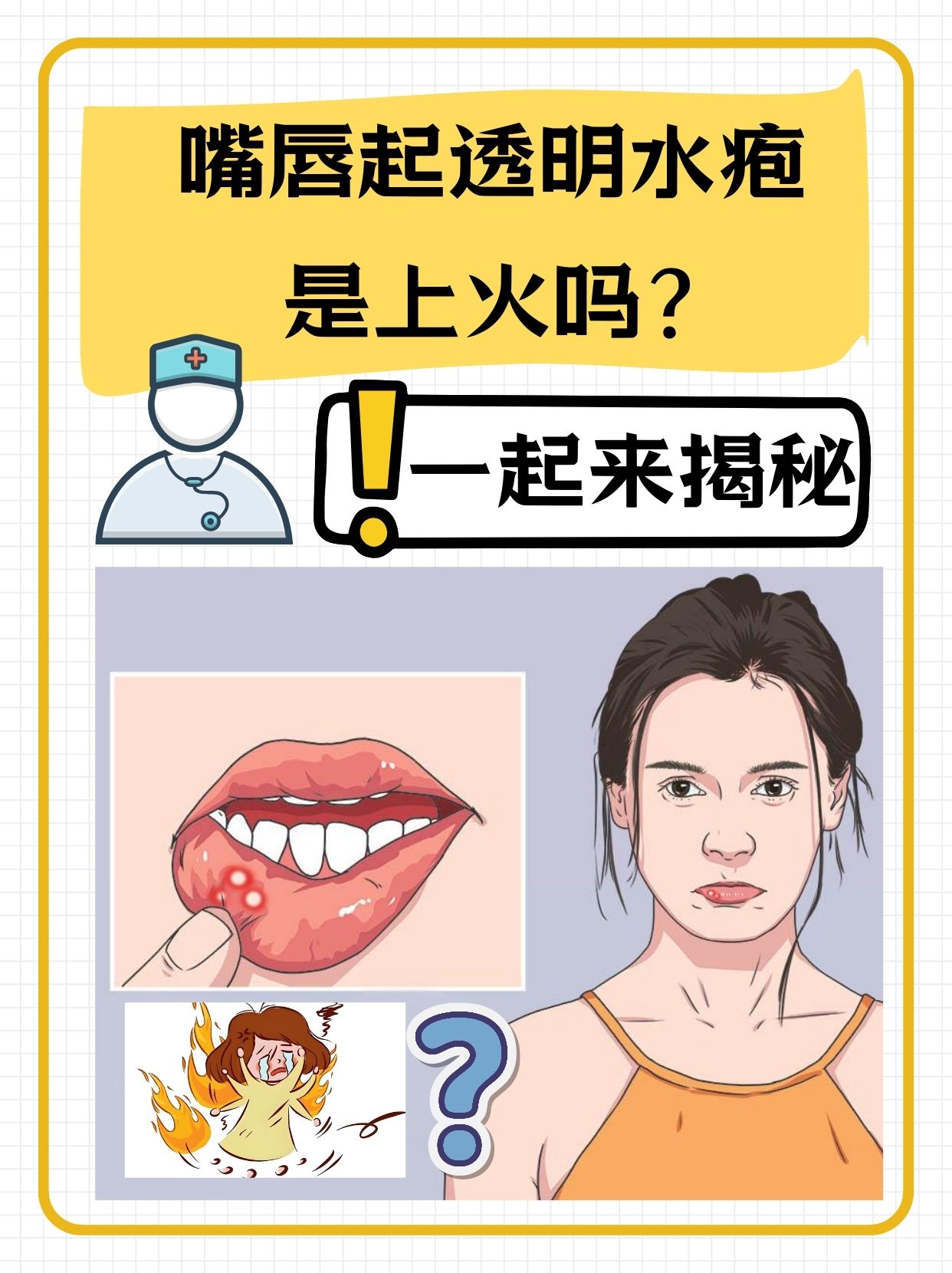 区别嘴唇上起疱疹怎么引起的嘴唇上火嘴唇起水泡上火嘴唇起泡图片卡通