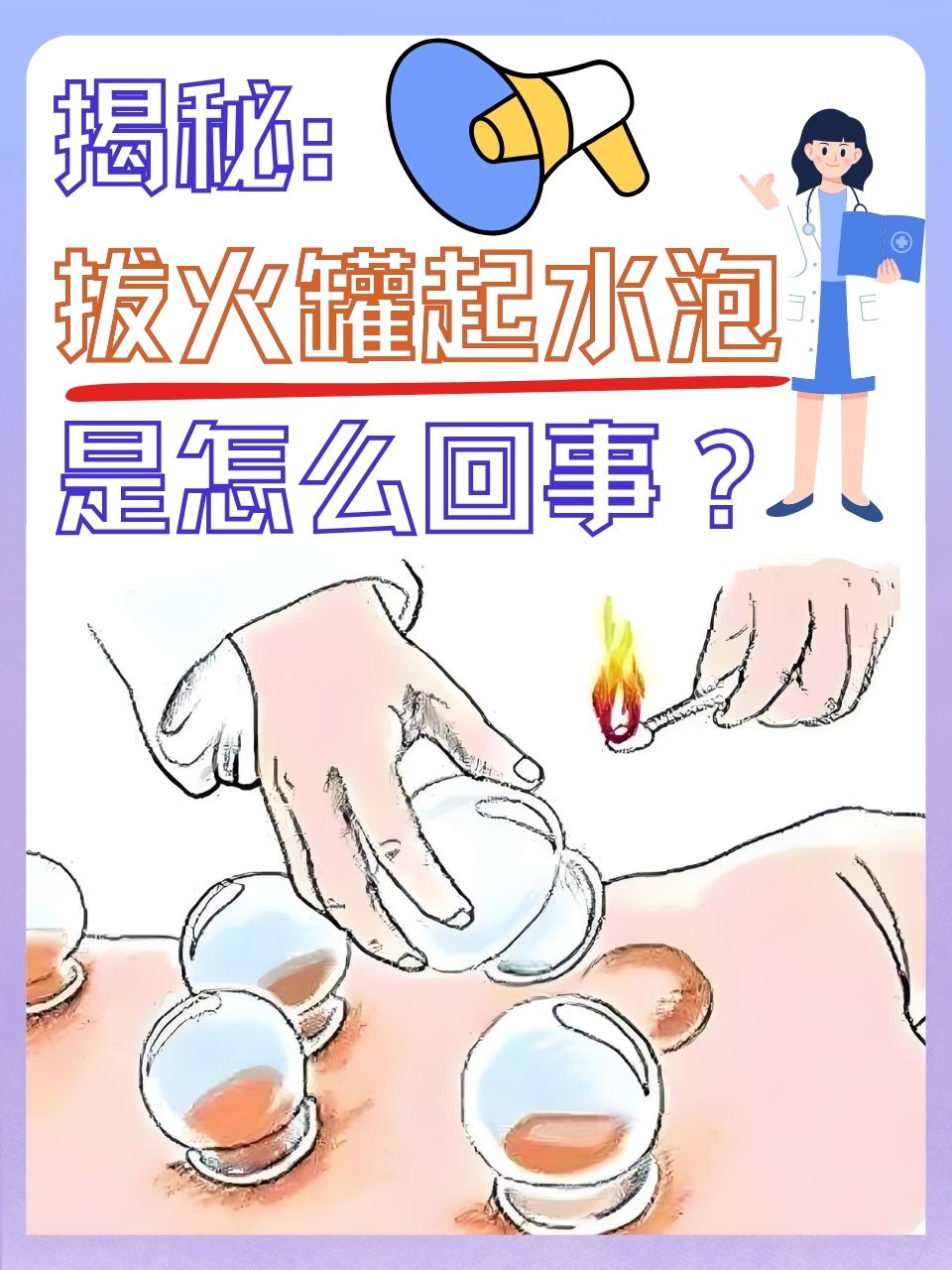 在日常生活中,拔火罐作为一种传统的中医疗法,被