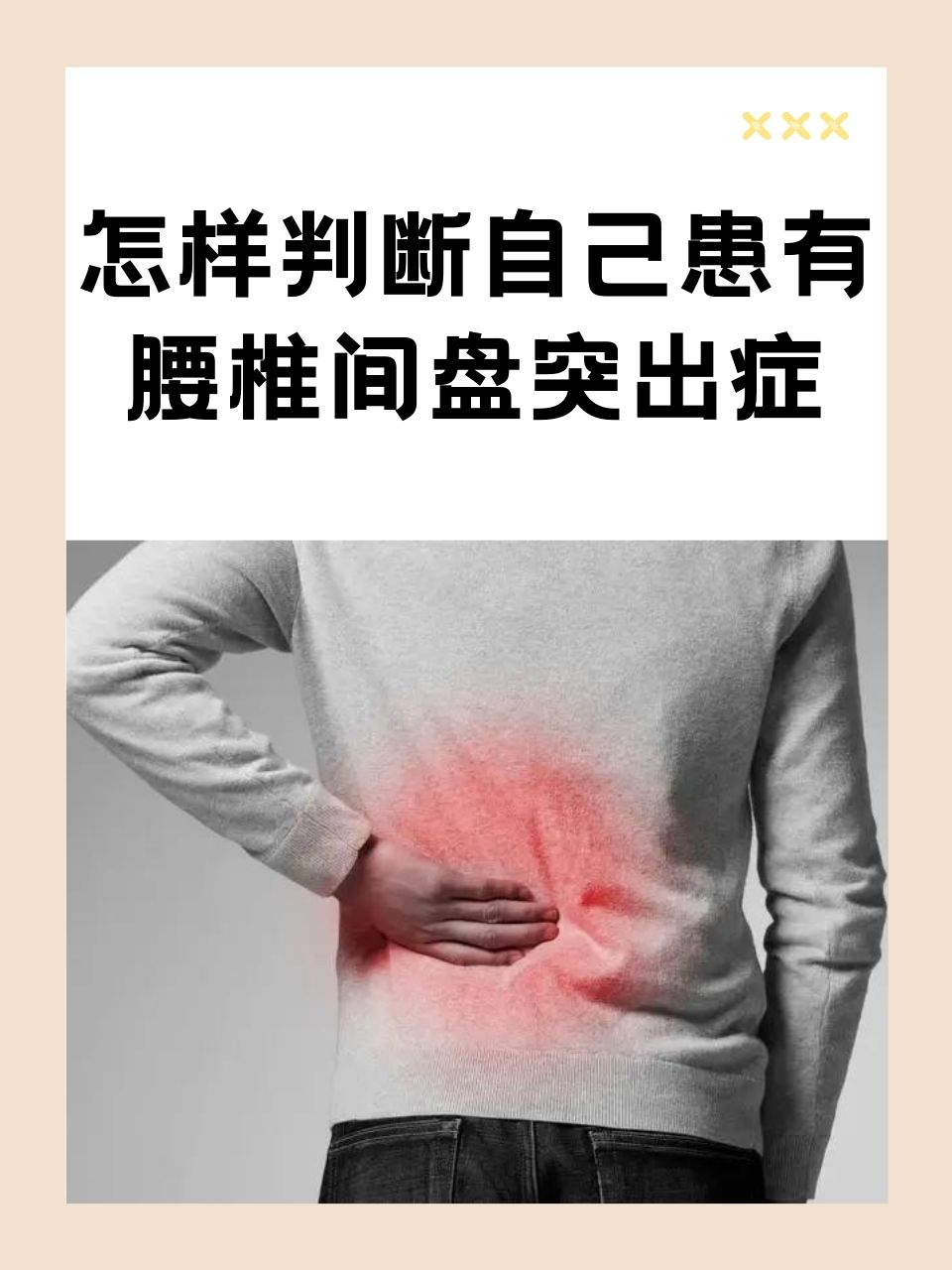 怎样判断自己腰间盘突出