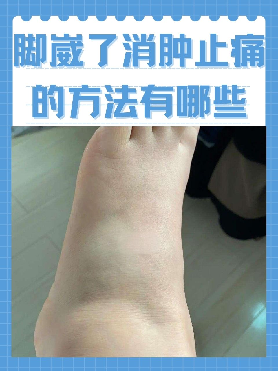 脚崴了消肿止痛的方法有哪些?