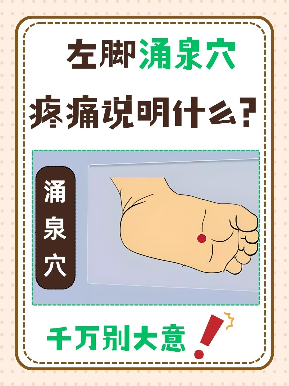 涌泉穴在脚底,当脚趾弯曲时,脚底前部凹陷处就是
