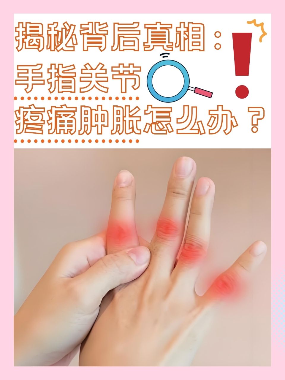 揭秘背后真相:手指关节疼痛肿胀怎么办?