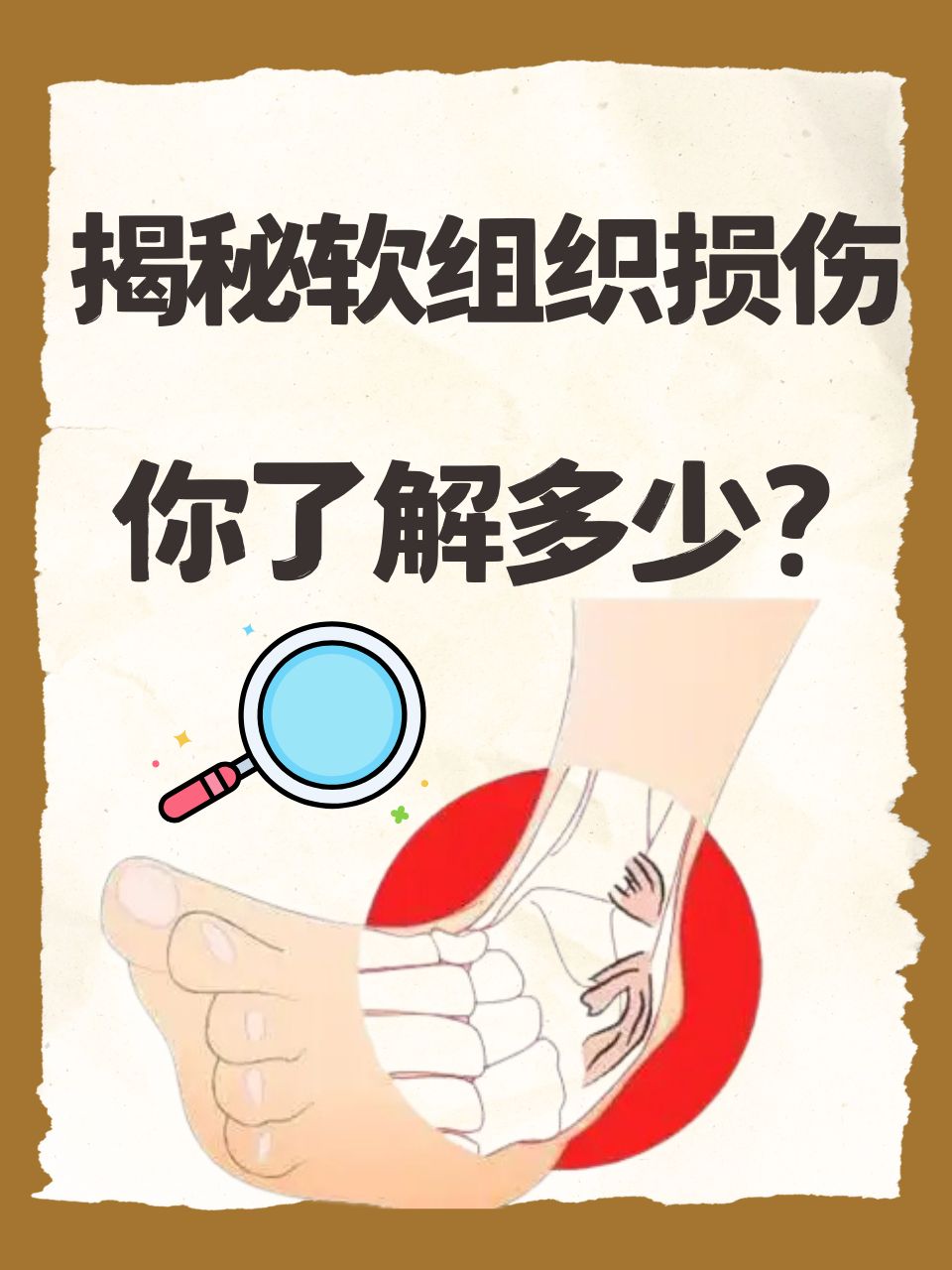揭秘软组织损伤,你了解多少?
