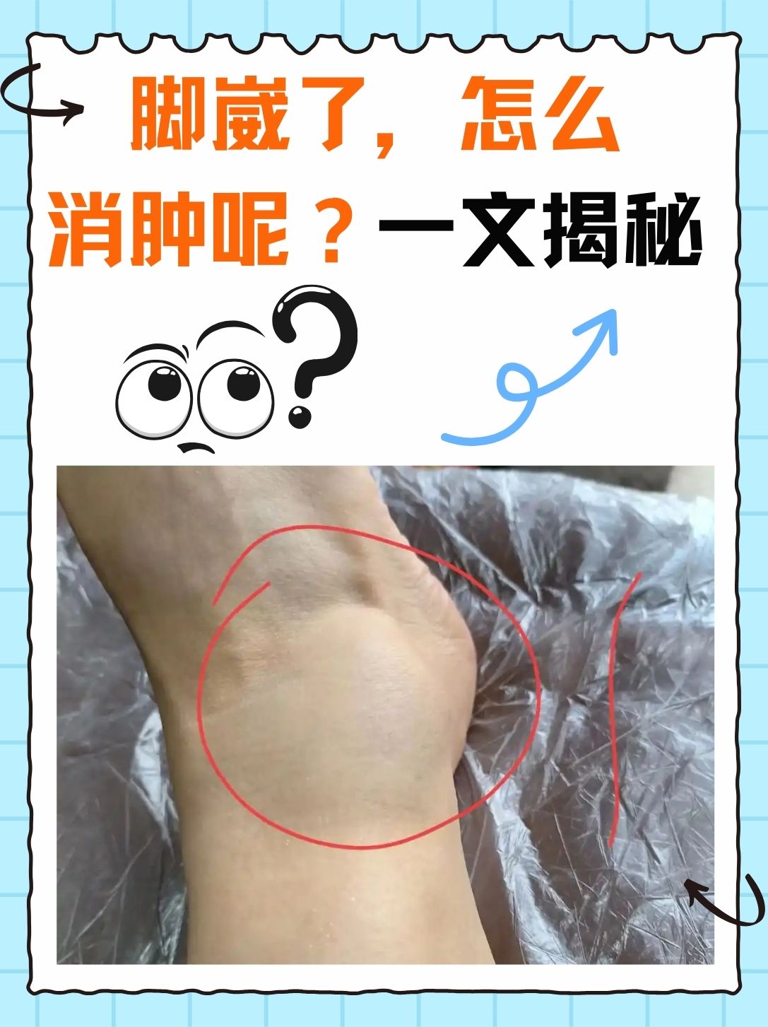相信不少人都有过这样的经历,那脚崴了肿了