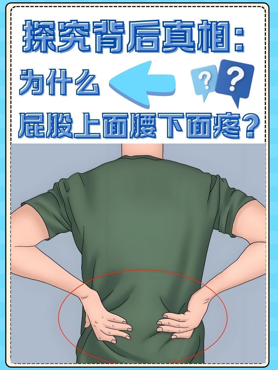 为什么会屁股痛
