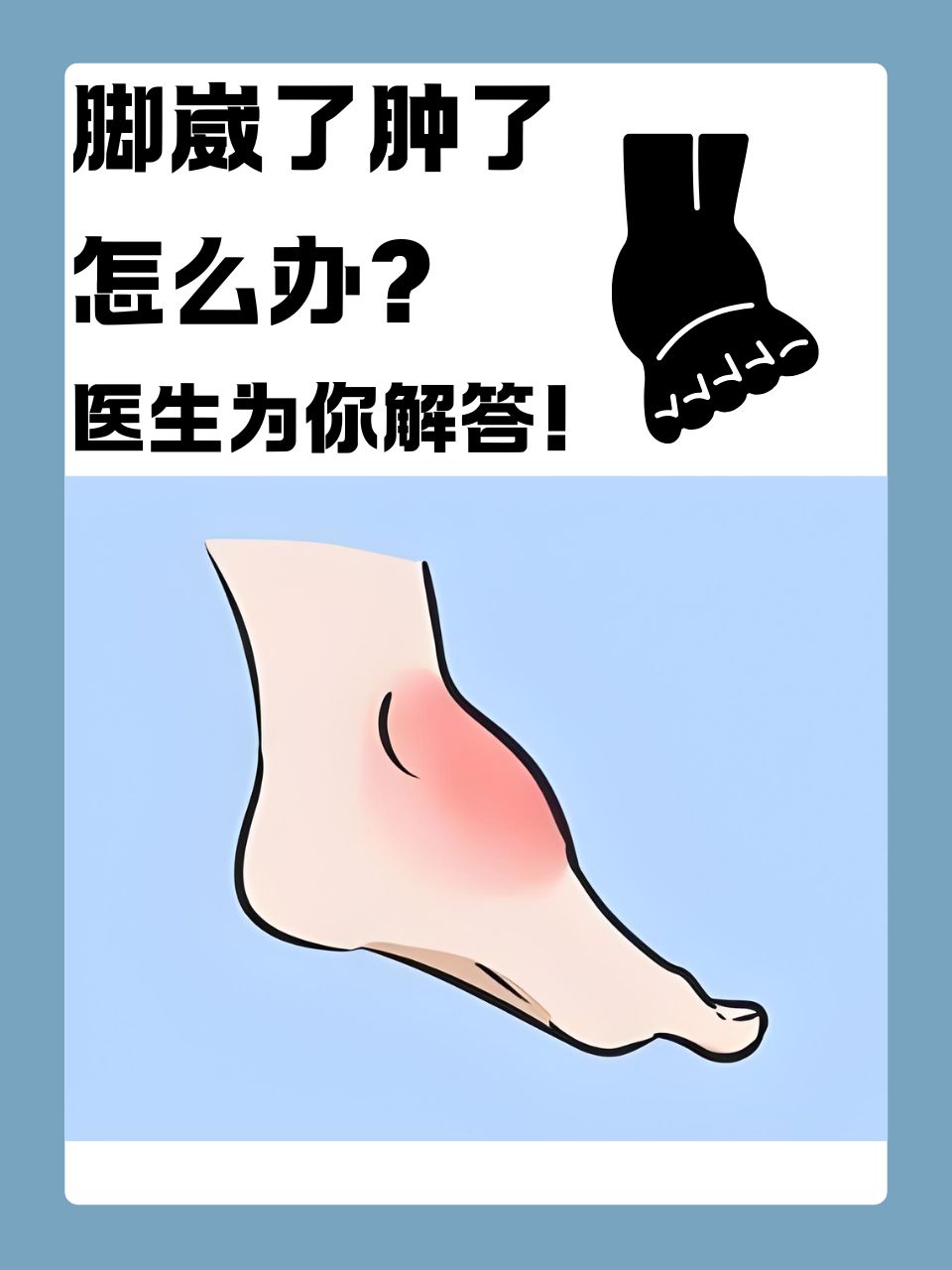 在日常生活中,崴脚是一种十分常见的运动和生活损伤