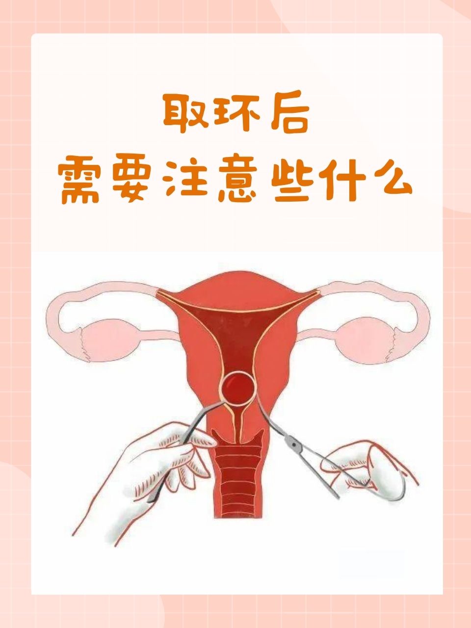 取环后需要注意些什么