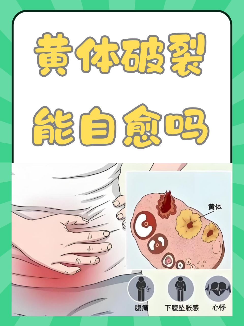 黄体破裂,一个在女性生理周期中可能遭遇的问题,时常让许多女性感到