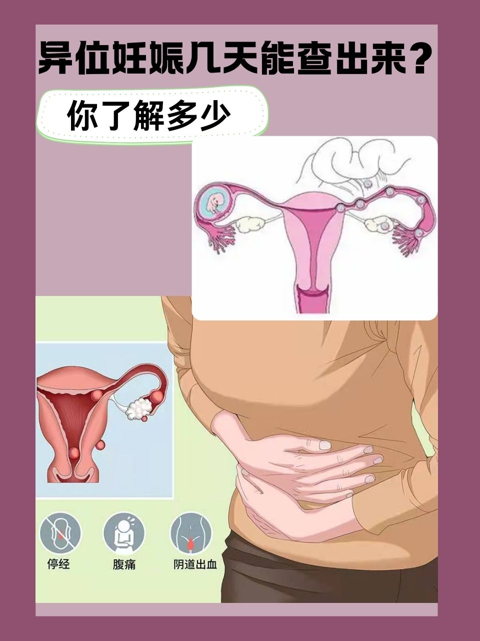 异位妊娠几天能查出来?