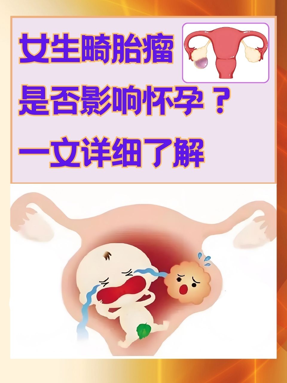 崎胎瘤需超度吗-崎胎瘤需要终止妊娠吗为什么 崎胎瘤需超度吗-崎胎瘤需要终止妊娠吗为什么