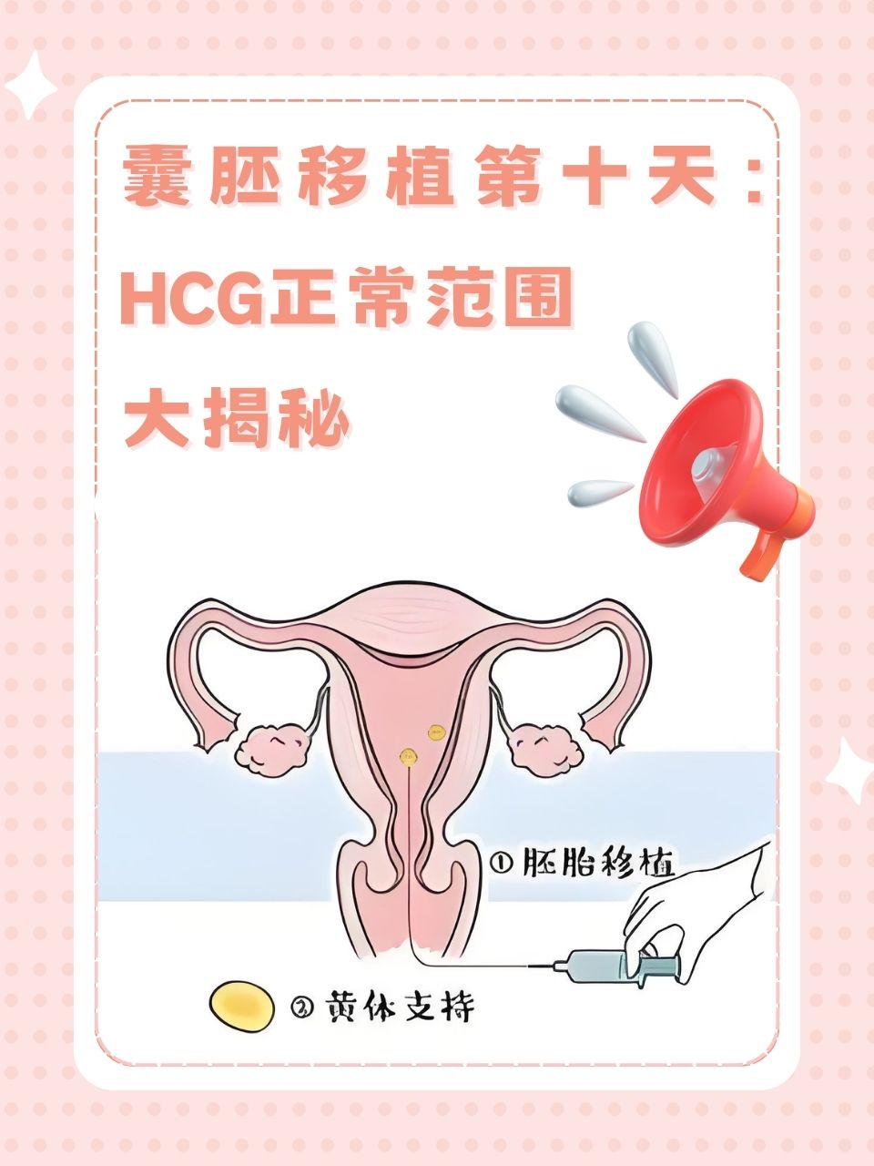 囊胚移植一个还是两个好_囊胚移植一个和两个成功率相同吗