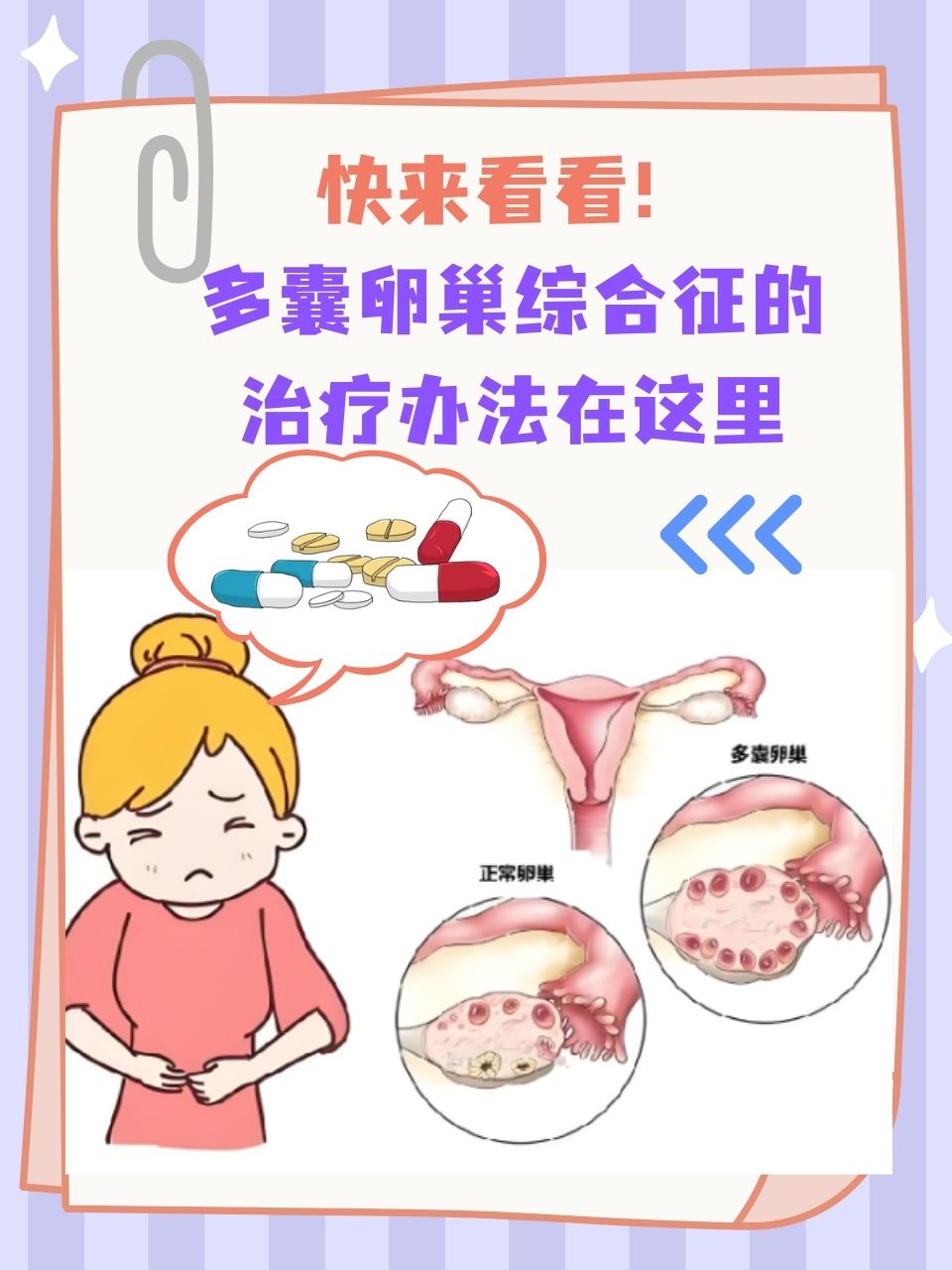 调理卵巢多囊有什么好方法(调理多囊卵巢的中成药有哪些)  第2张