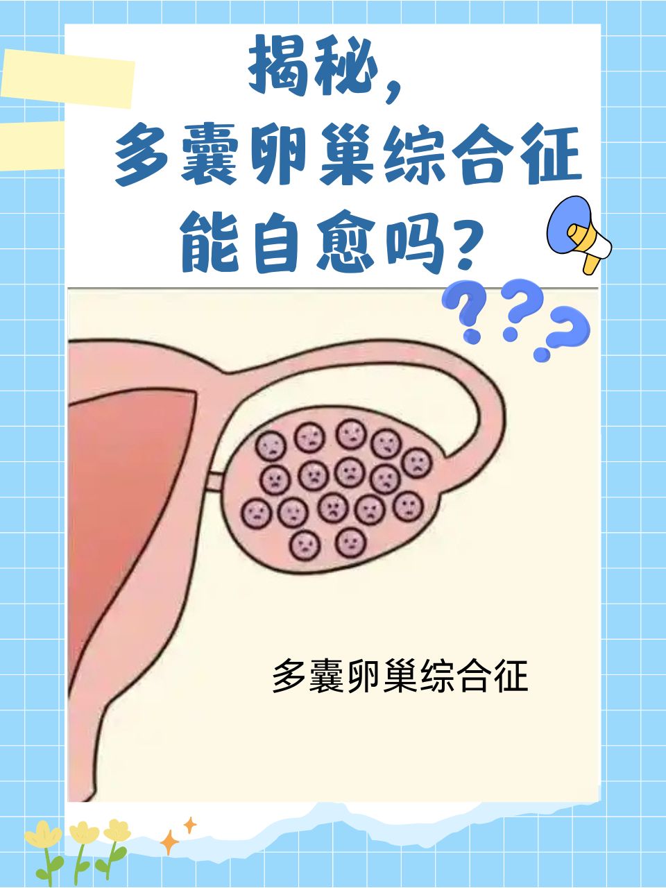 多囊性卵巢综合症的治方法_多囊卵巢综合症患者治疗方法