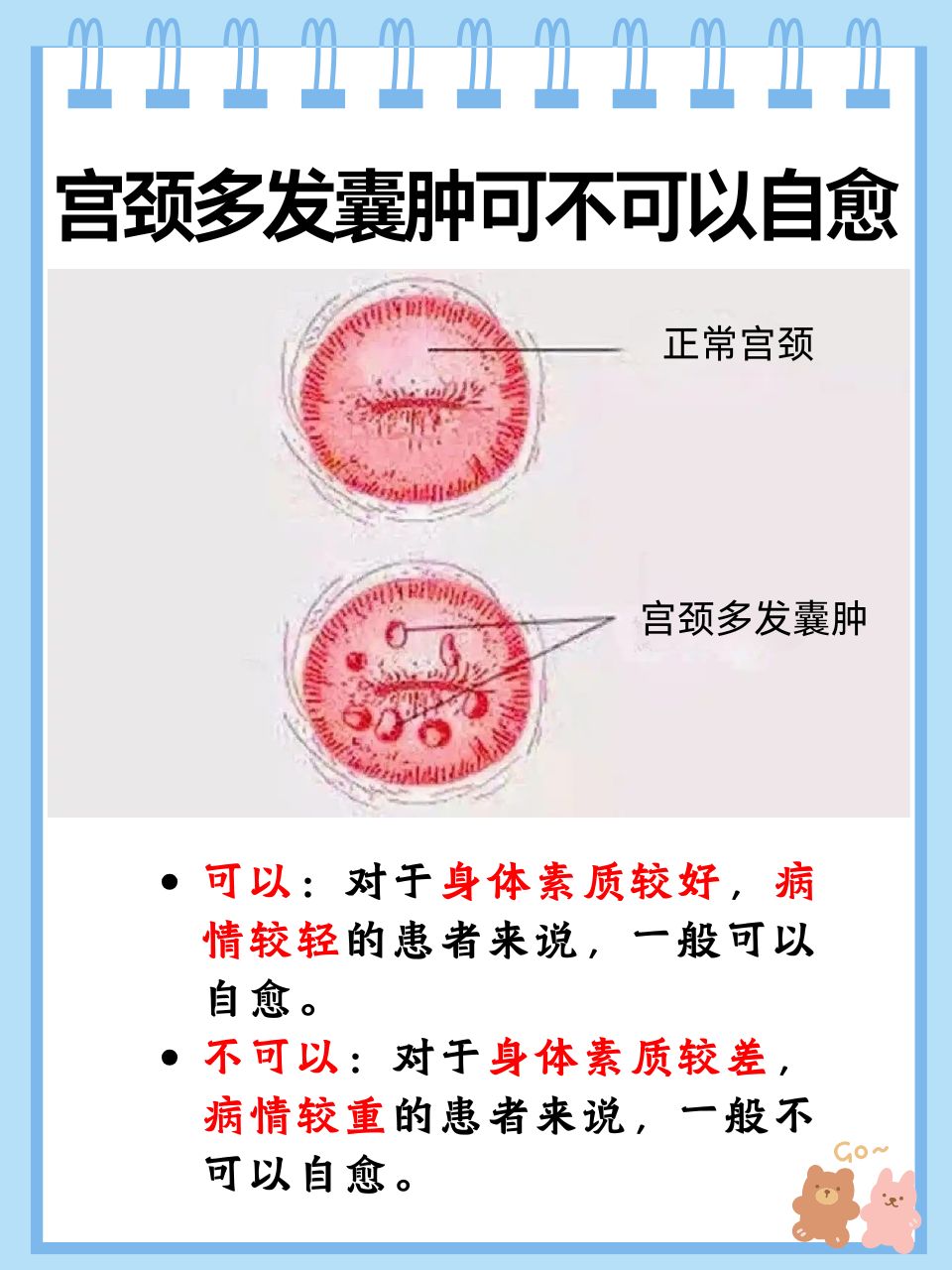 宫颈多发囊肿能否自愈?一文详解!