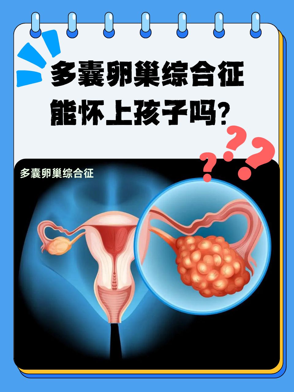 为什么会得多囊卵巢症的原因为什么在线 为什么会得多囊卵巢症的原因为什么在线