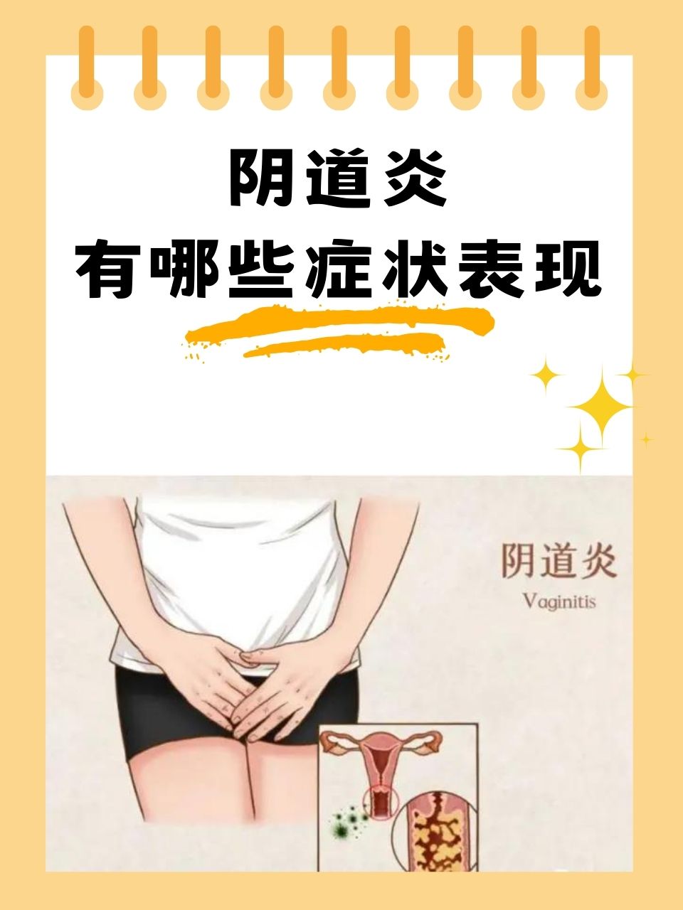 阴道炎作为一种常见的妇科疾病,困扰着许多女性朋友.