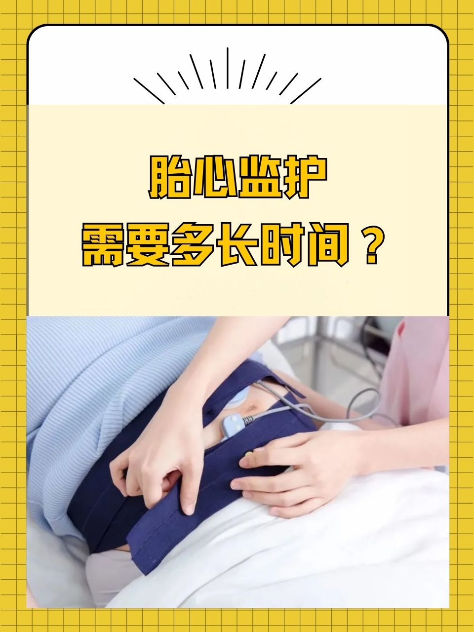 当我们满怀期待地等待着新生命的降临,胎心监护就像是一盏明灯,为