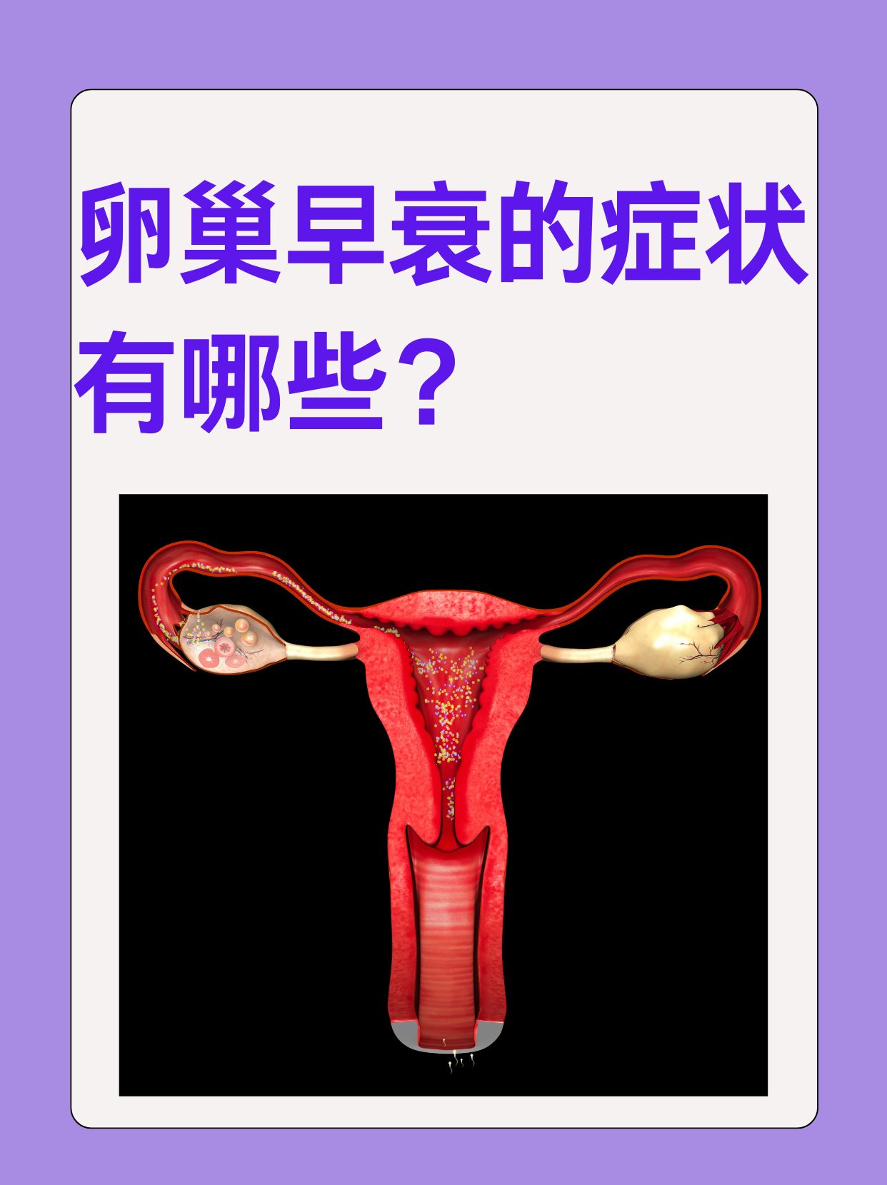 卵巢对于女性的重要性不言而喻,它不仅关系到生育能力,还对女性的