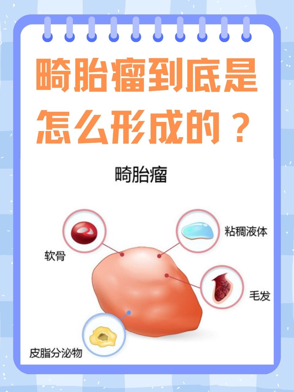 人为什么会得肿瘤 人为什么会得肿瘤