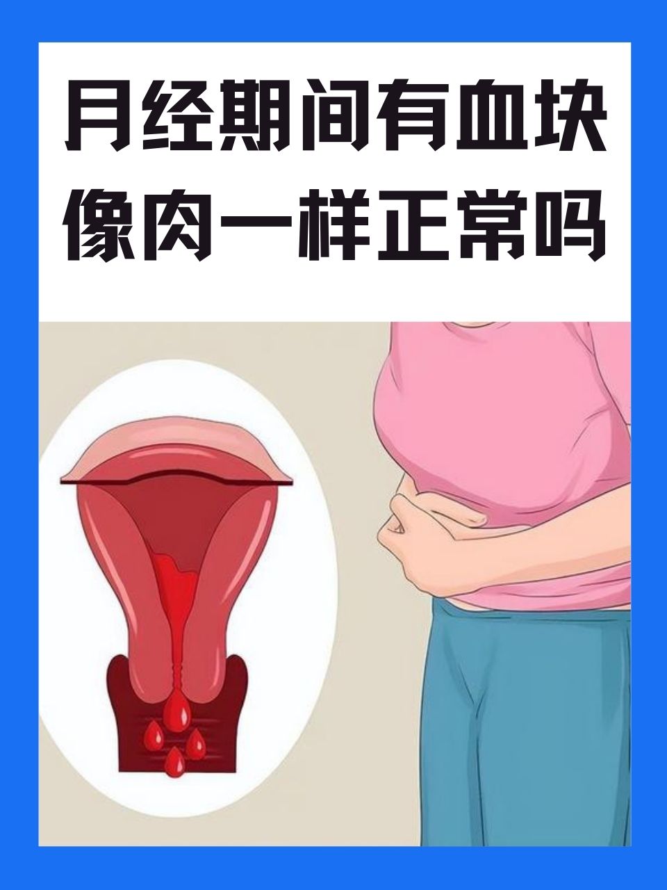 子宫内膜脱落症状图片