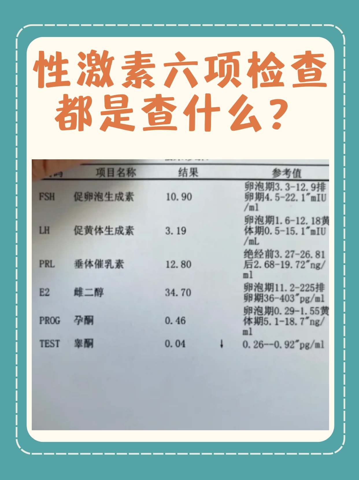 性激素六项检查都是查什么?