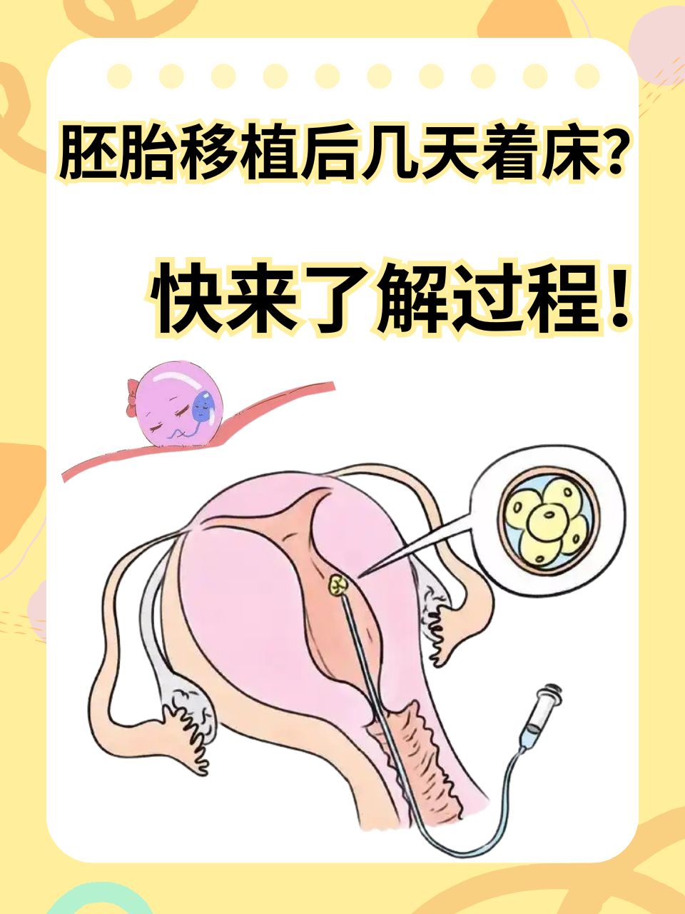 试管移植后躺_试管移植后躺多久可以离开