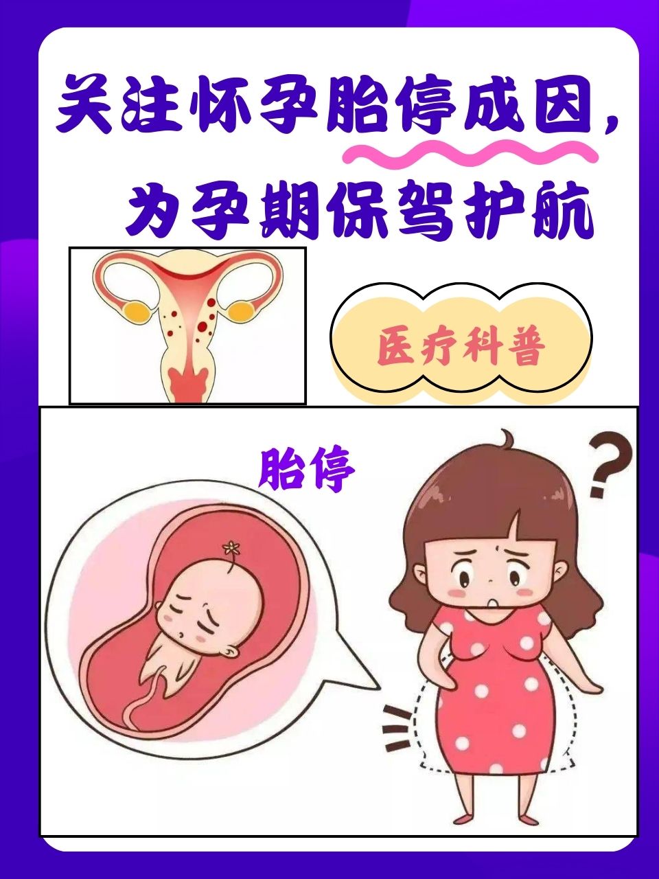 刚发现怀孕怎样终止