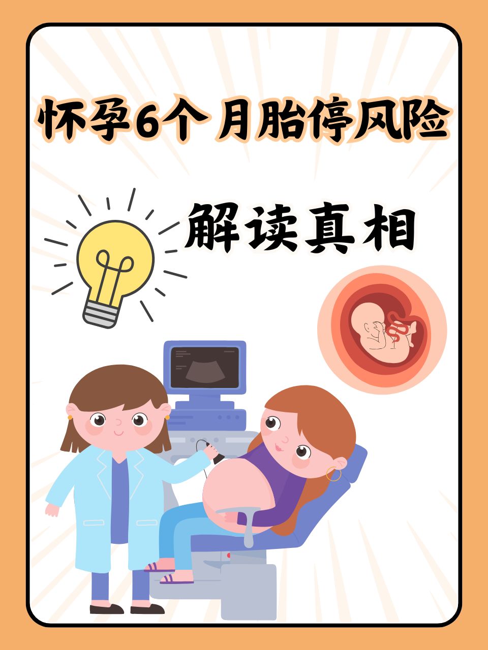 怀孕32周会胎停吗(孕32周会胎死腹中吗)  第2张