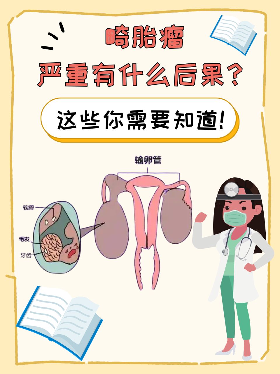 畸胎瘤是受精形成的胚胎吗?_畸胎瘤是受精形成的胚胎吗会怀孕吗