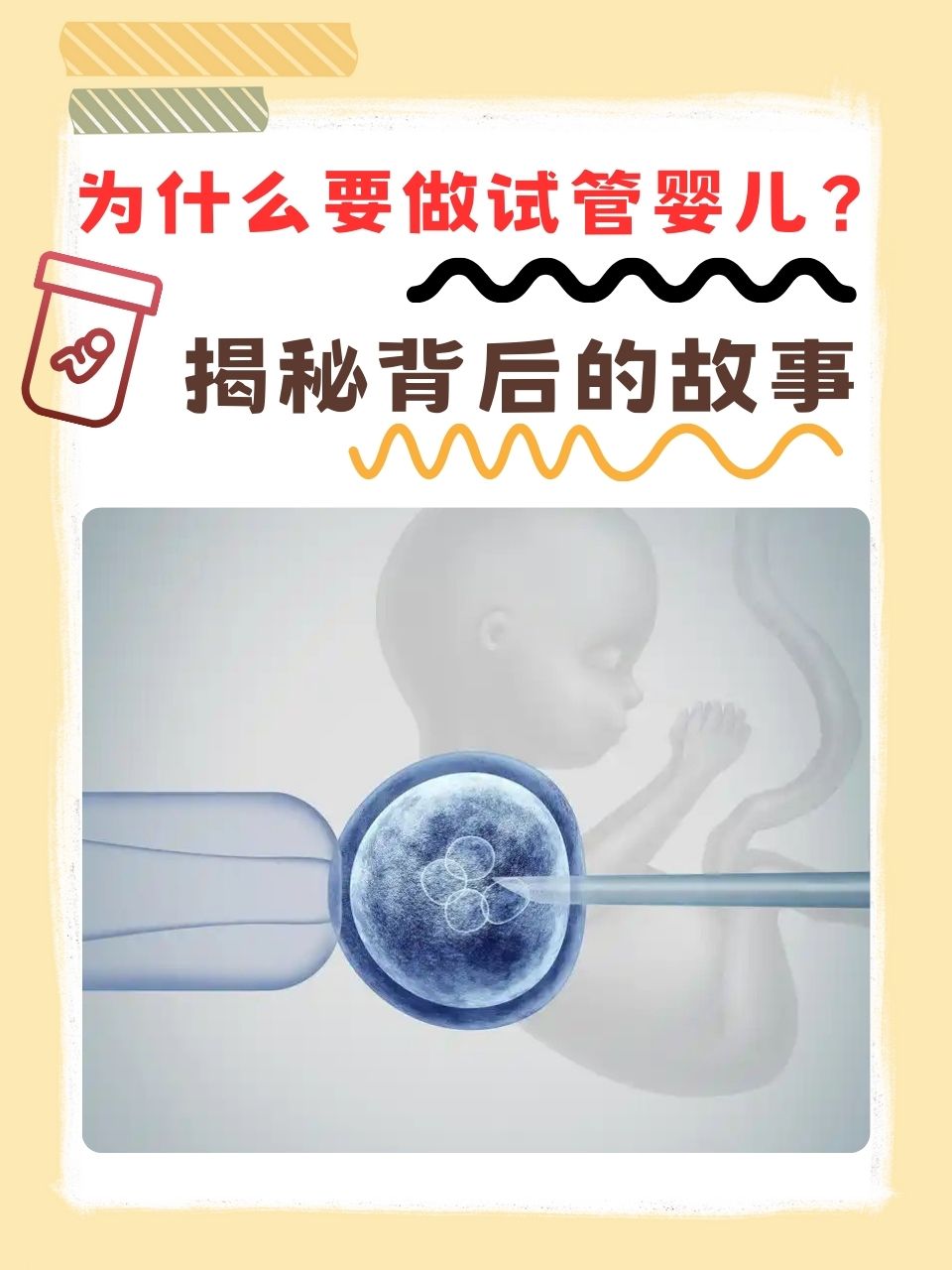 试管儿选择男女费用(试管婴儿男女双方要具备什么条件)  第2张