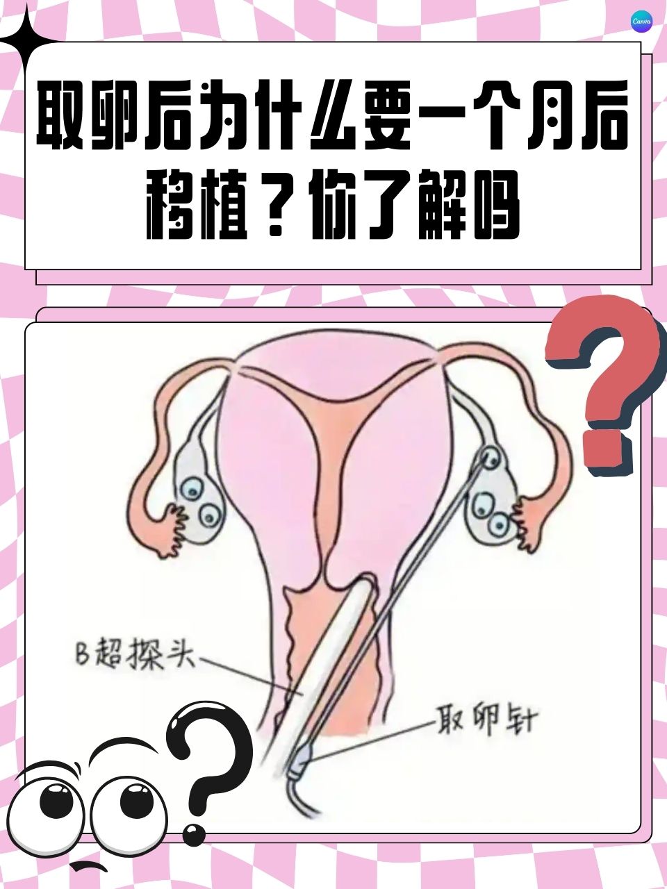 试管鲜胚移植的过程(试管婴儿鲜胚移植过程)  第2张