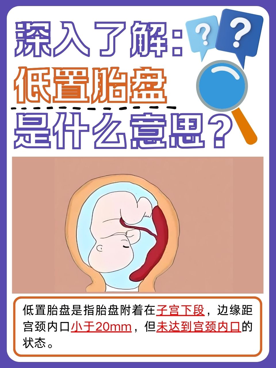 然而,有一种名为低置胎盘的现象,却可能悄然成为孕期安全的潜在威胁