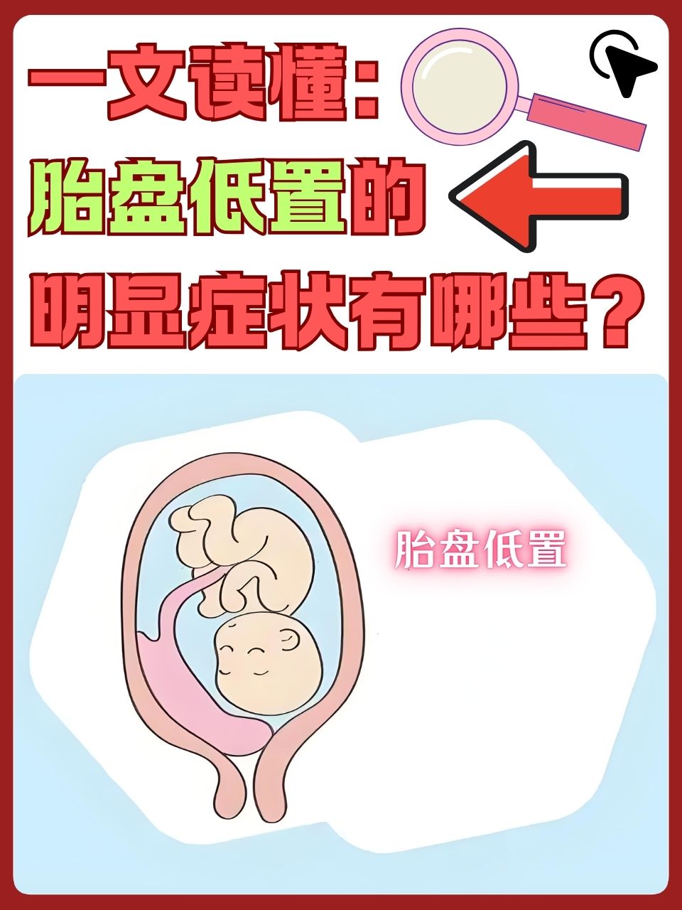 一文读懂:胎盘低置的明显症状有哪些?