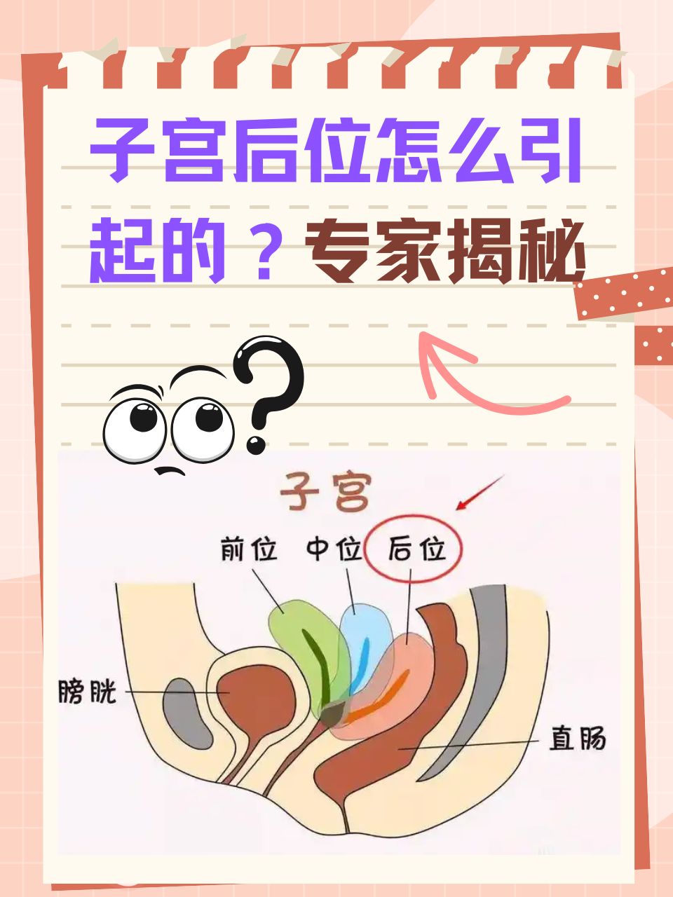 专家揭秘  在女性生殖健康的领域里,子宫后位是一个较为常见的话题